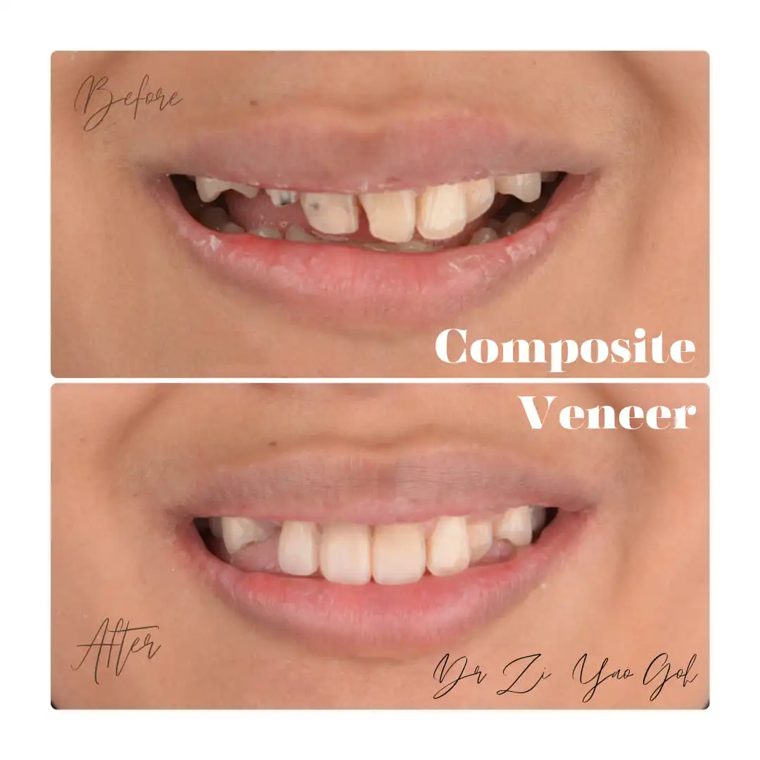 Description of image 1